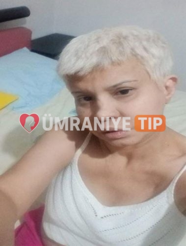 Alev fotoğrafı